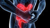 Colite o sindrome dell'intestino irritabile (IBS) quali sono le cause e le possibili soluzioni?